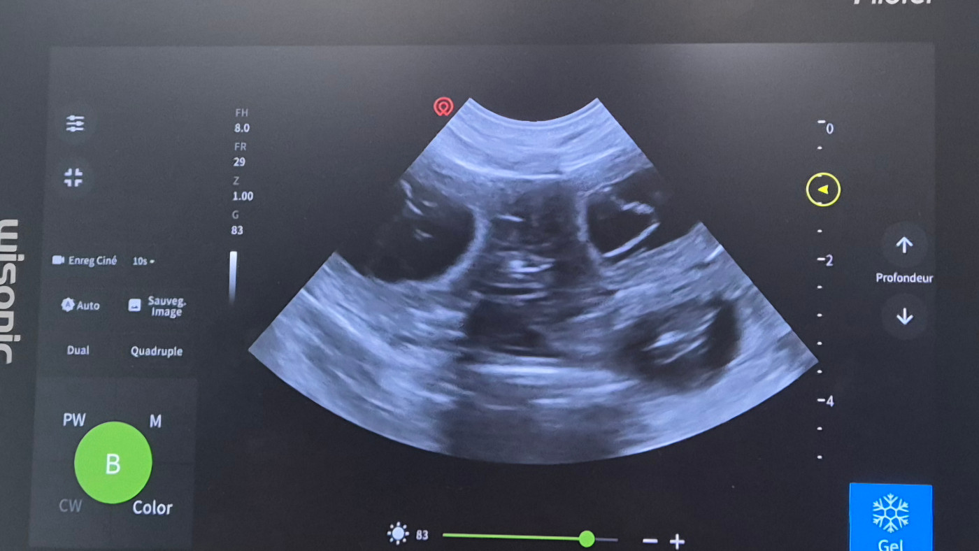 Des bébés pour la Toussaint 